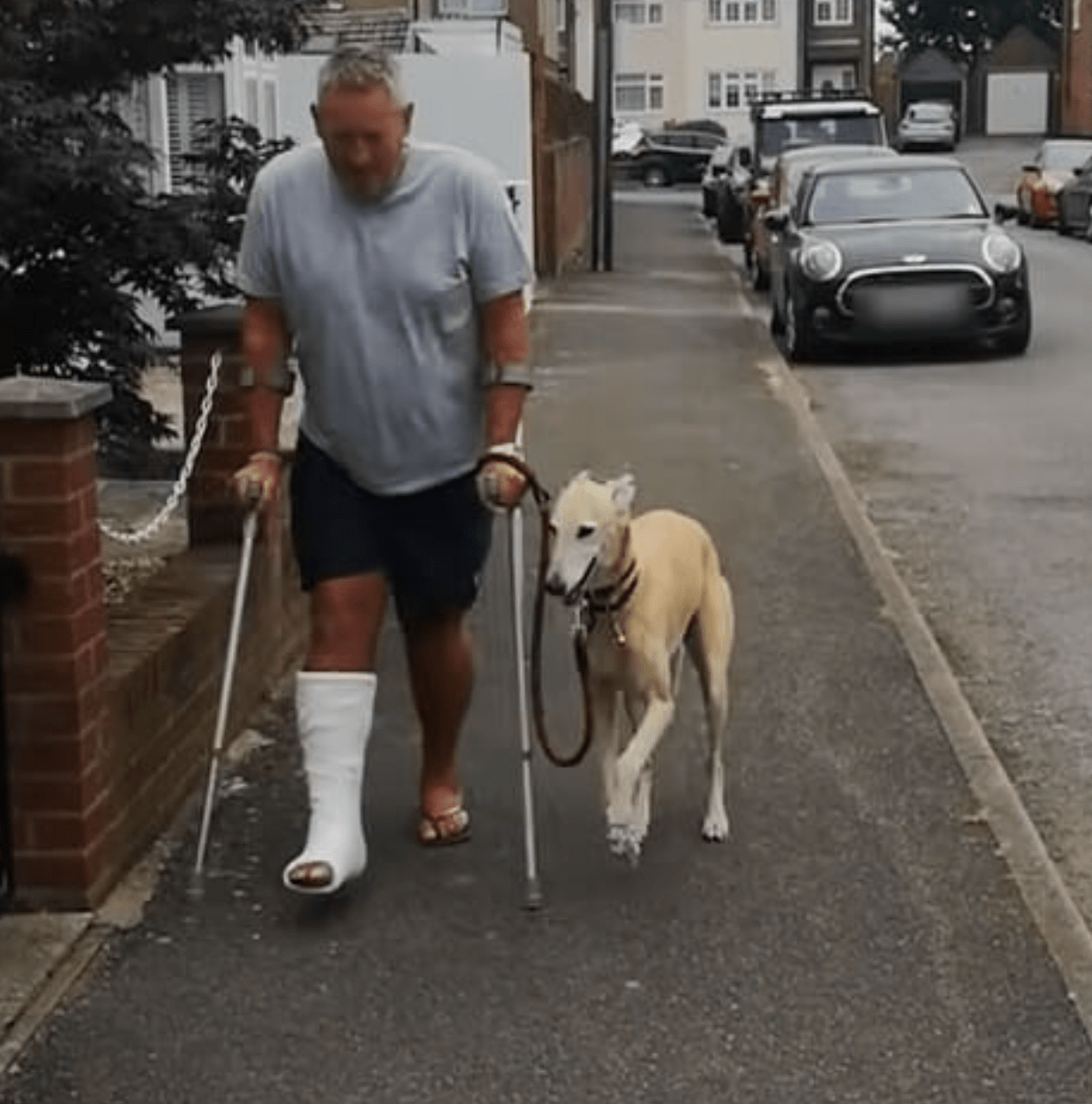 After $400 Trip to Vet, Man Learns His Limping Dog Was Just Copying Him Out of Sympathy