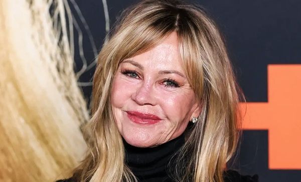 Melanie Griffith with a noticeable mark on her cheek