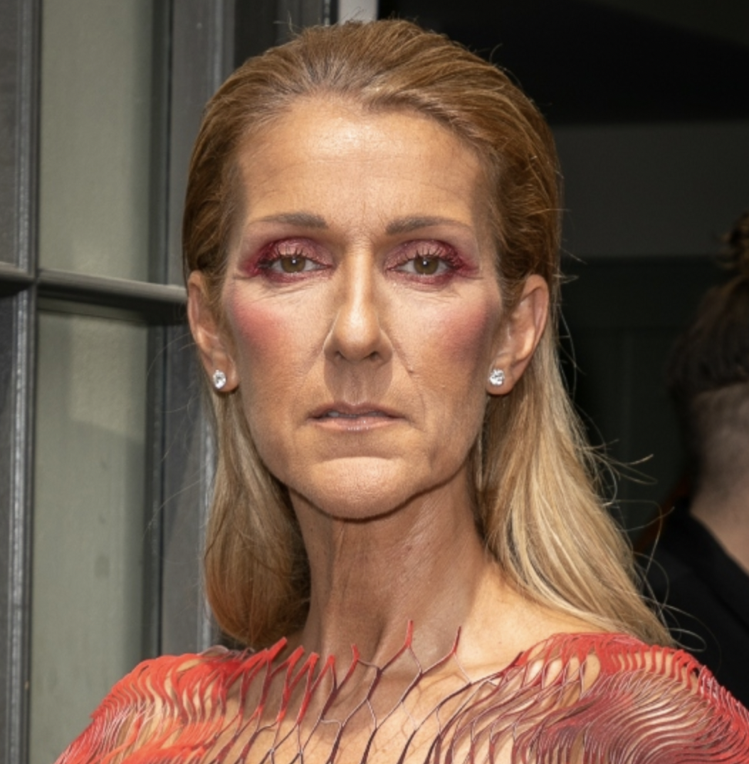 Céline Dion’s Health Update: A Sister’s Perspective