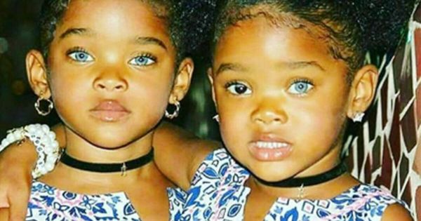 Megan and Morgan: The Adorable “Trueblue Twins”