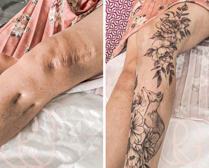 Transforming Scars into Beautiful Art with Tattoos