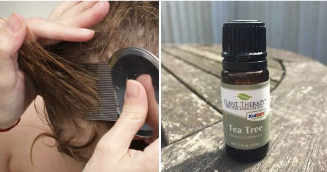 Preventing Head Lice with Tea Tree Oil