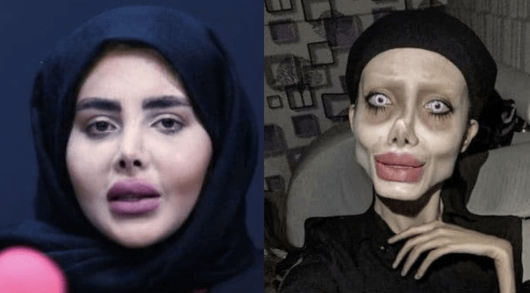 Sahar Tabar: A Controversial Transformation