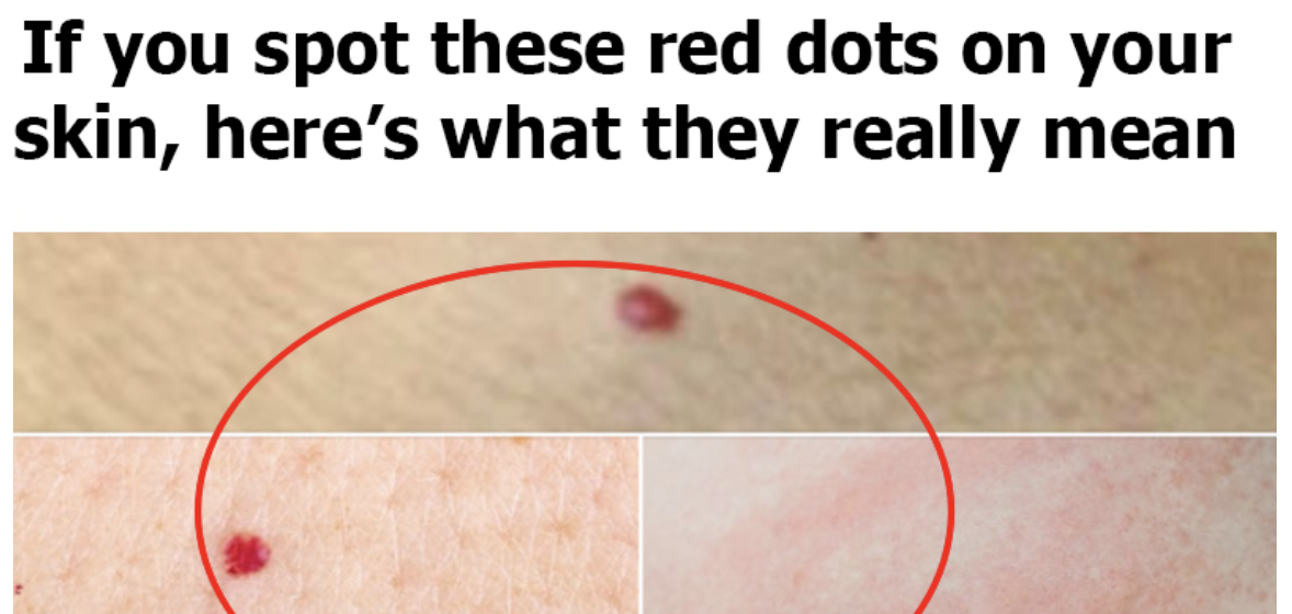 If You Spot These Red Dots on Your Skin, Here’s What They Really Mean