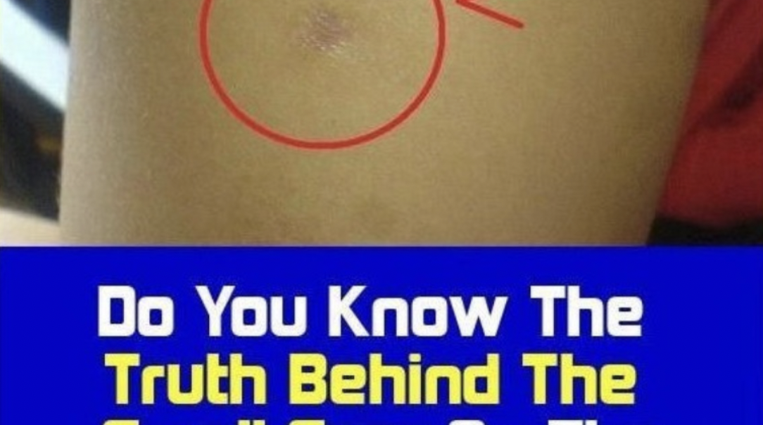 The Truth About the Scar on Your Upper Left Arm