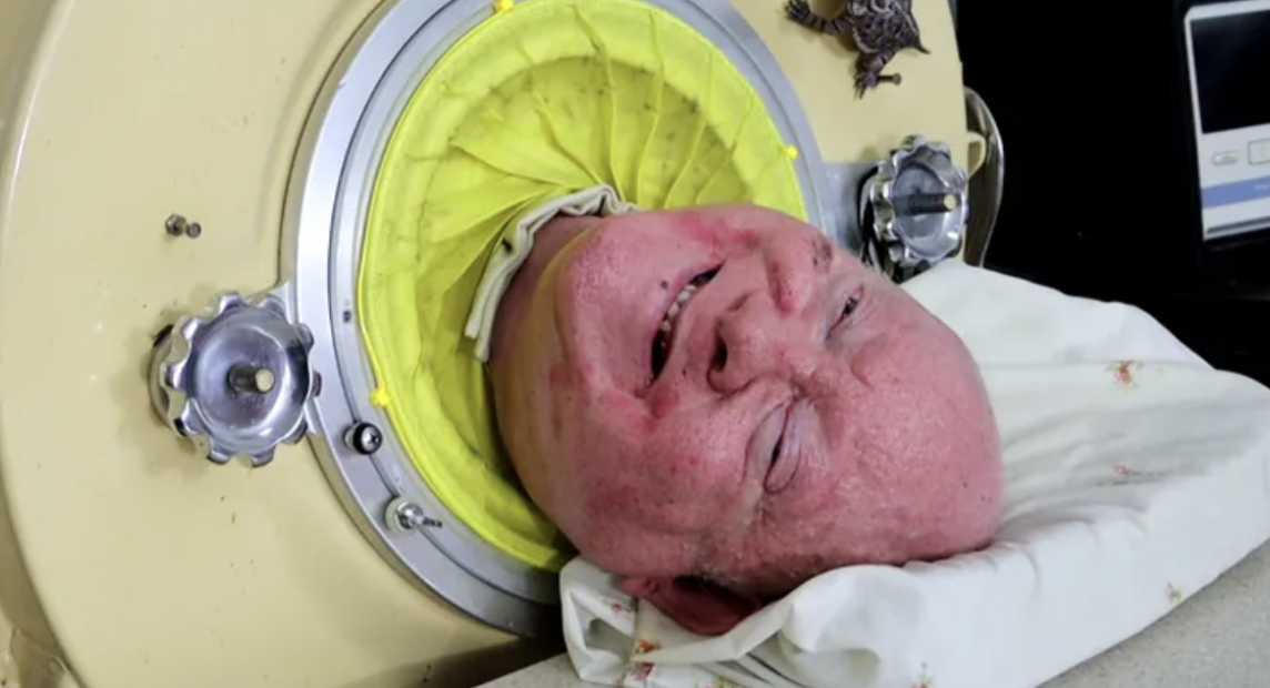 The Last U.S. Man Living In An Iron Lung Has Passed Away