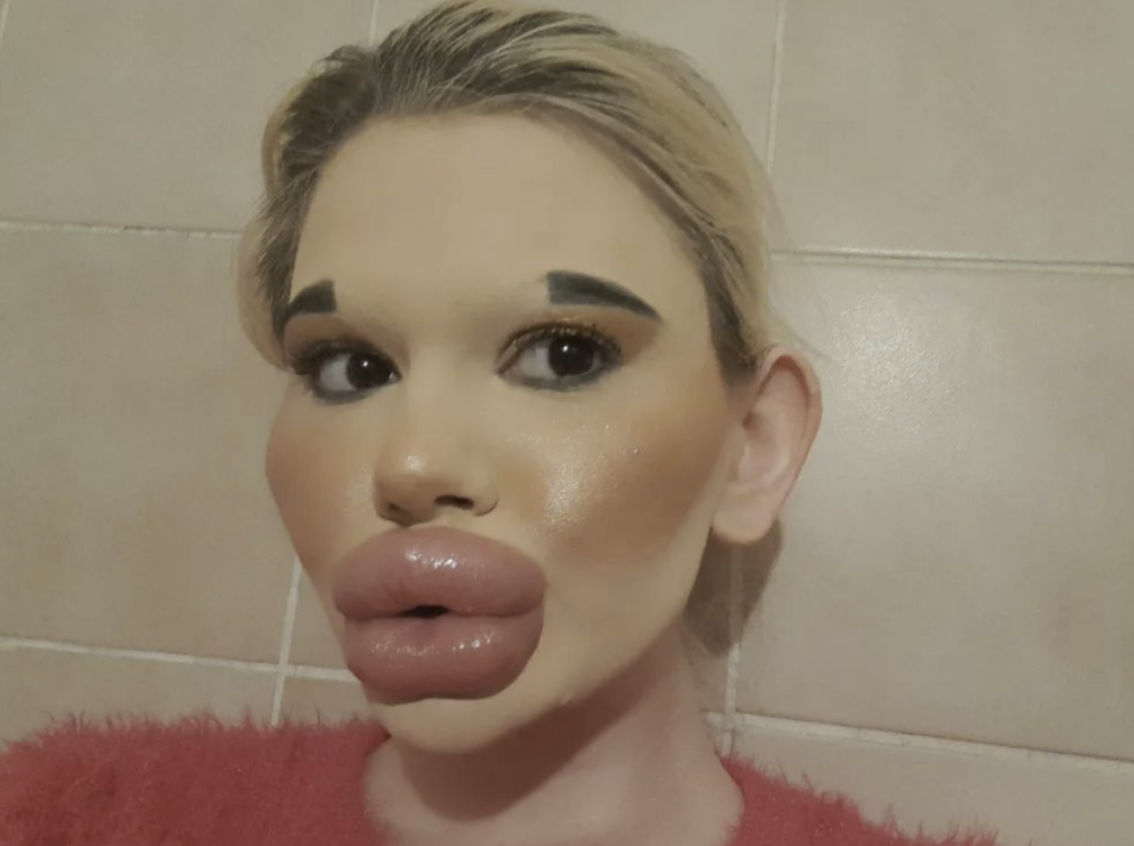 Pursuing Her Dream: Meet Andrea, the 24-Year-Old with the Biggest Lips in the World!