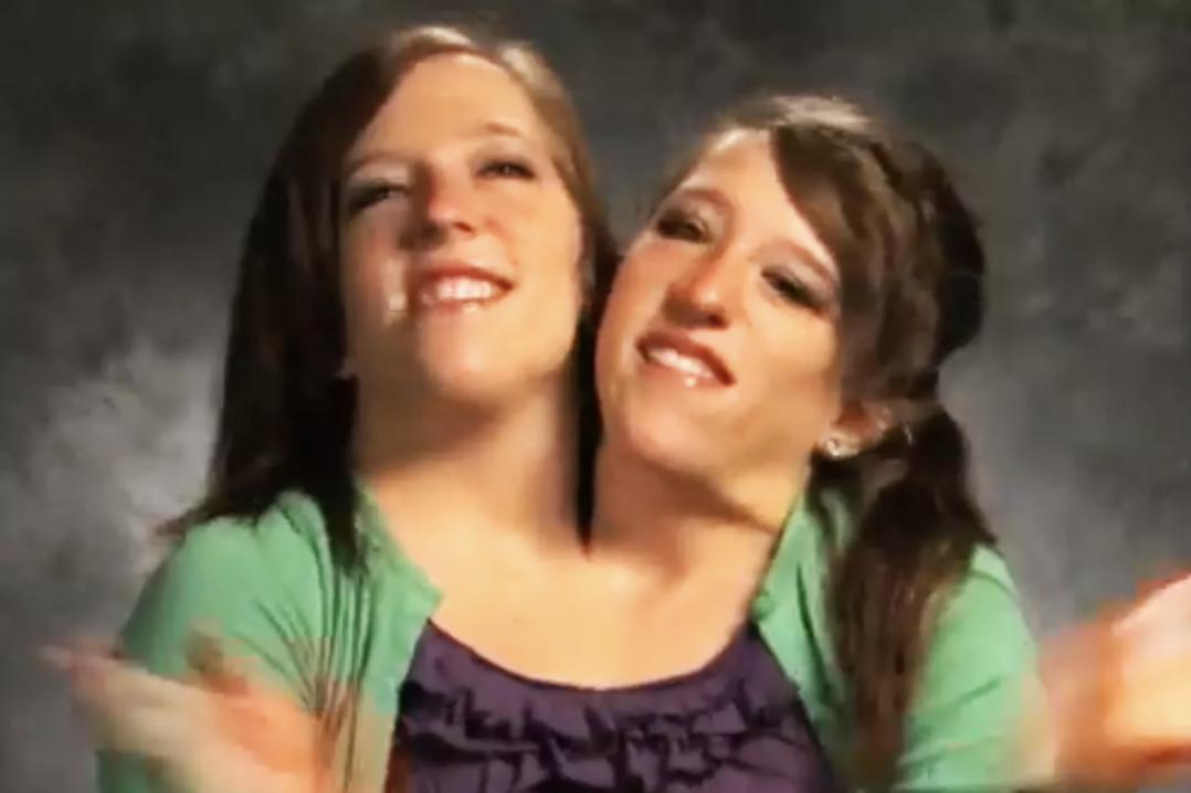 Conjoined Twin Abby Hensel Gets Married