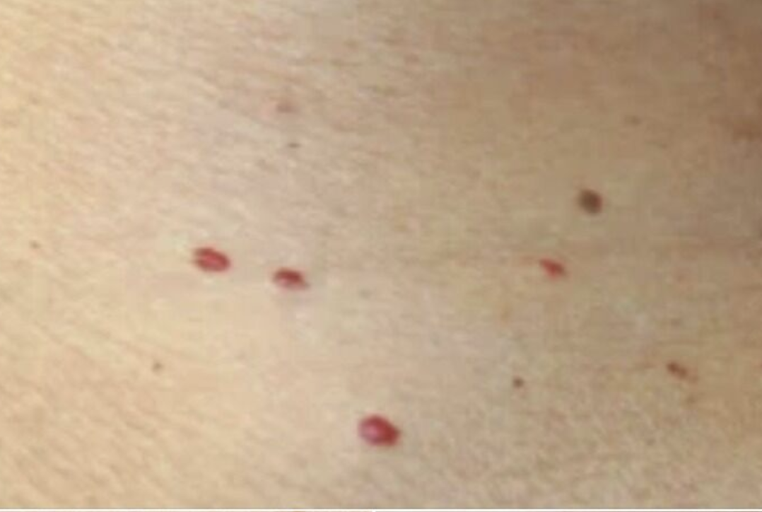 Red Dots on Your Skin: Causes and When to Seek Help