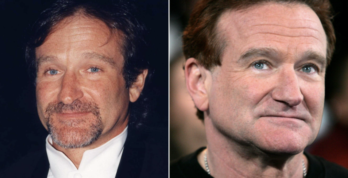 Robin Williams’ Struggle with Lewy Body Dementia