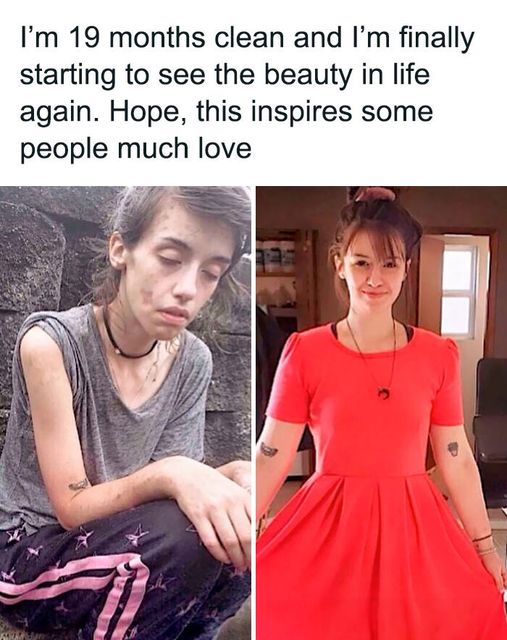 10 Before and After Pictures of People Who Have Overcome Addiction