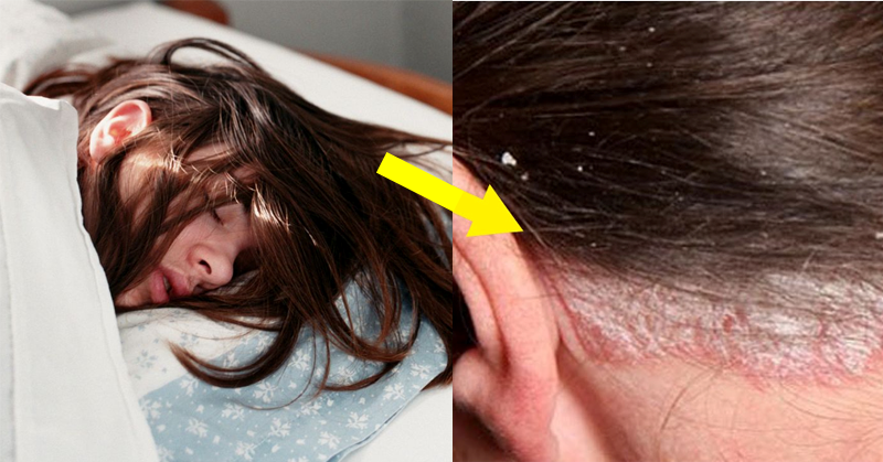 Reasons You Should Never Go to Sleep with Wet Hair: No.4 Is the Most Serious