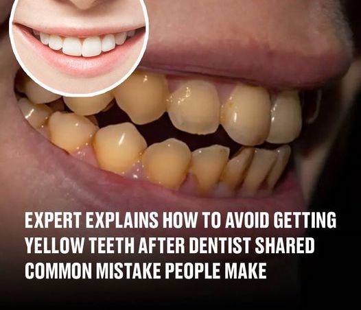 Dentist says there is one common mistake that leads to people’s teeth turning yellow