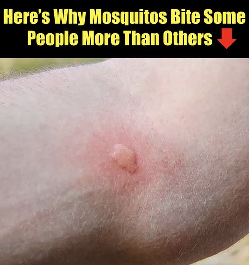 Here’s Why Mosquitos Bite Some People More Than Others