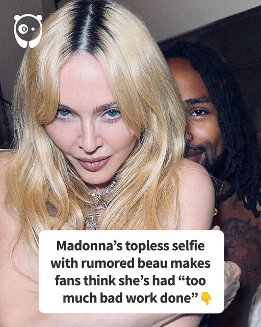 Madonna’s Topless Selfie With Rumored Beau Makes Fans Think She’s Had “Too Much Bad Work Done”