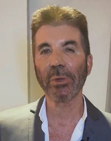 Simon Cowell's changed appearance